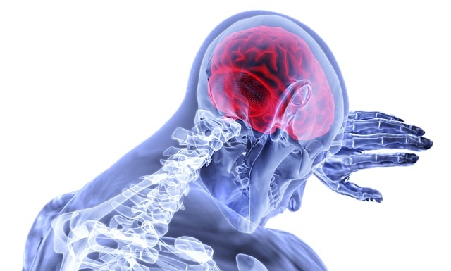 What Compensation Can I Receive for My Traumatic Brain Injury