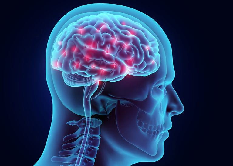 Traumatic Brain Injury Lawsuit in Ohio